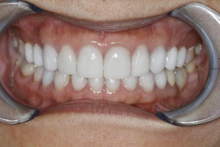 Konig Center for Cosmetic & Comprehensive Dentistry smile photos